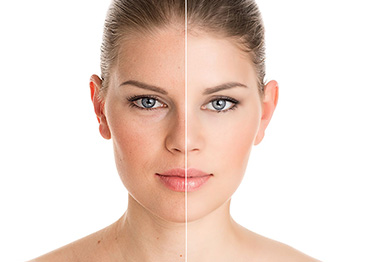 Cosmetic Injectables - Absolute Smile