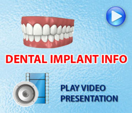 Dental Implant Info