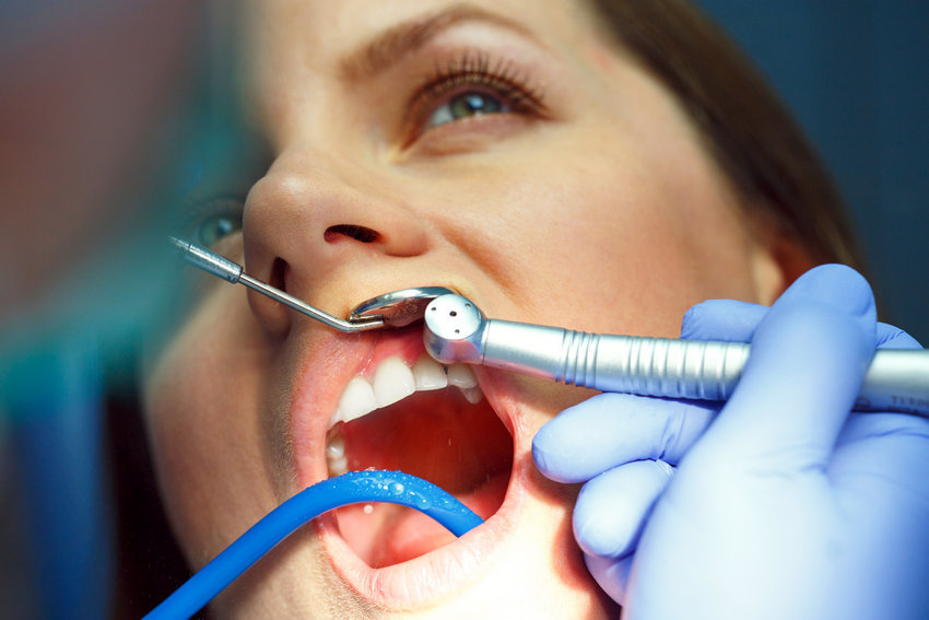 Woman Getting a Dental Treatment - Absolute Smile