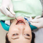 The Influence Of Oral Health And Hygiene On Our Bodies-Absolute Smile