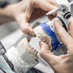 Are Dental Implants Right for You?-Absolute Smile