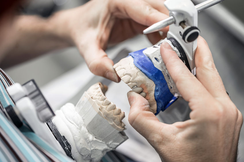 Are Dental Implants Right for You?-Absolute Smile