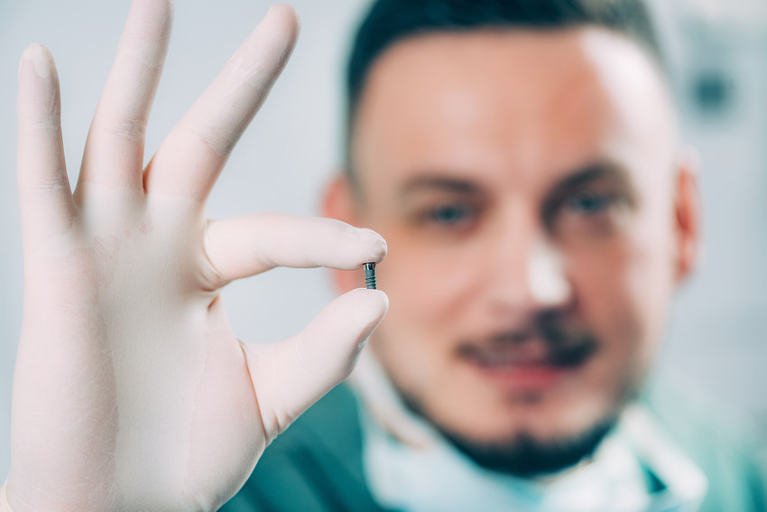 Everything You Need to Know About Dental Implants-Absolute Smile