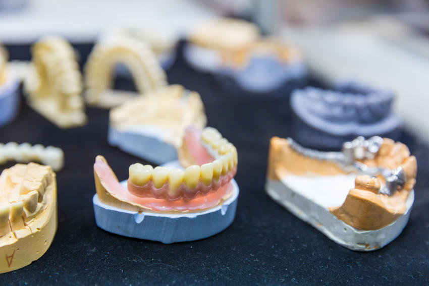 Dental Implants 1-Absolute Smile