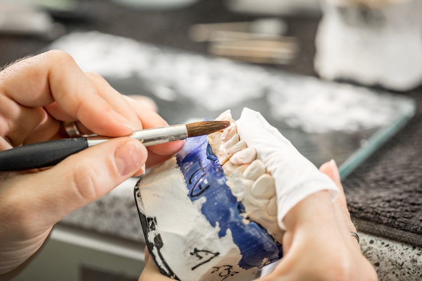 Dental Implants: Where To Start-Absolute Smile