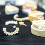 Dental Implants: Where To Start-Absolute Smile