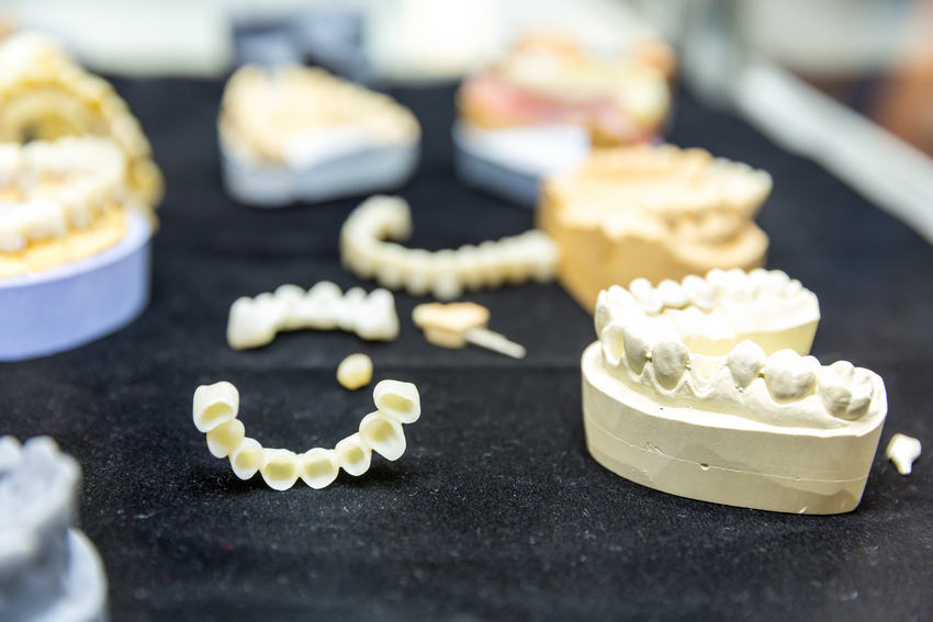 Dental Implants: Where To Start-Absolute Smile