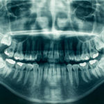 Tight Jaw Muscles: Causes and Relief Methods-Absolute Smile