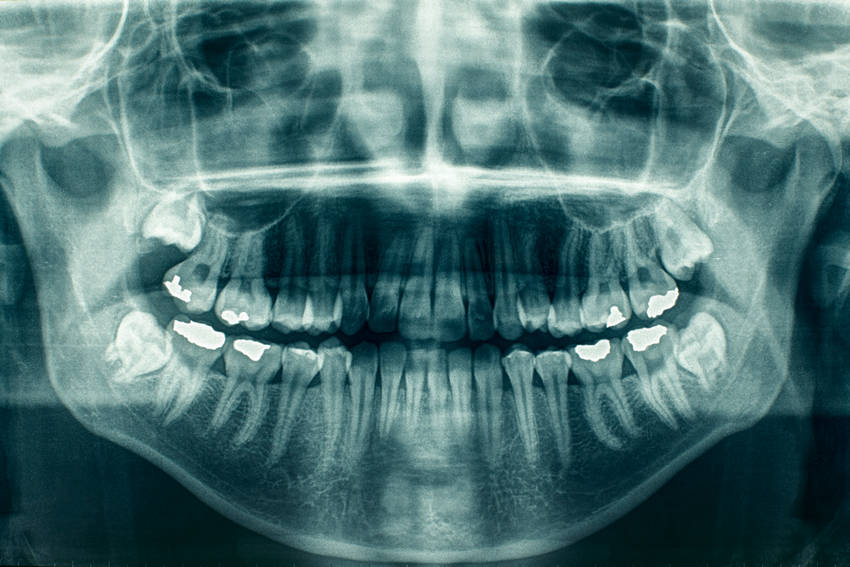 Tight Jaw Muscles: Causes and Relief Methods-Absolute Smile