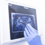 Advanced Periodontal Care in Philadelphia, PA