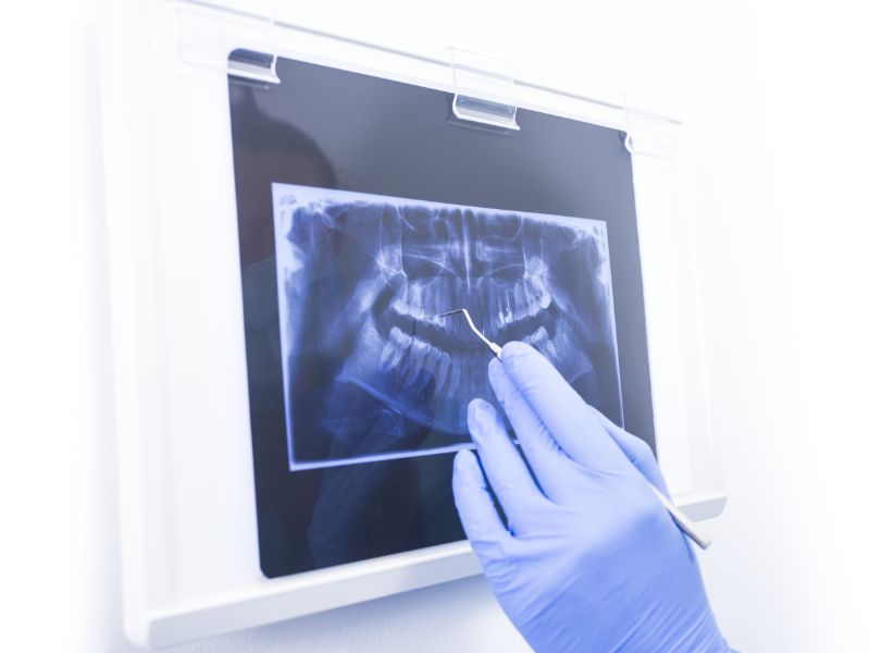 Advanced Periodontal Care in Philadelphia, PA