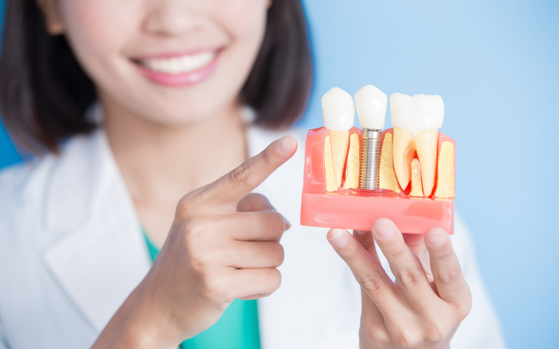 graphic illustration of dental implant recovery stage