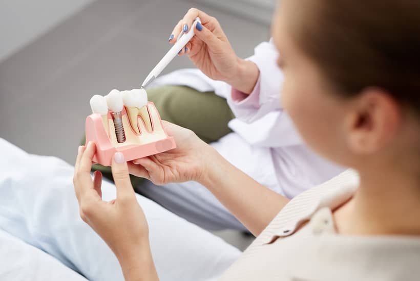 The Advantages of Full-Arch Dental Implants Vs Dentures