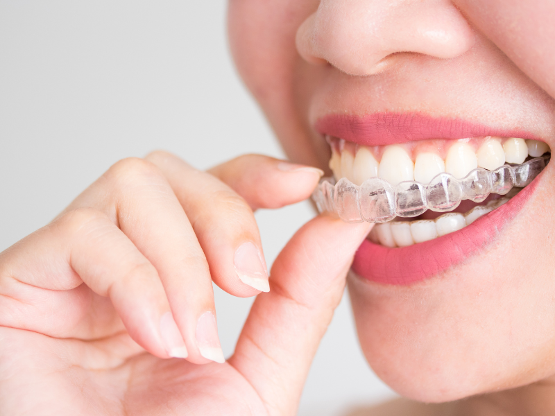 Invisalign treatment in Philadelphia PA