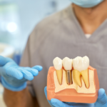 benefit of dental implant