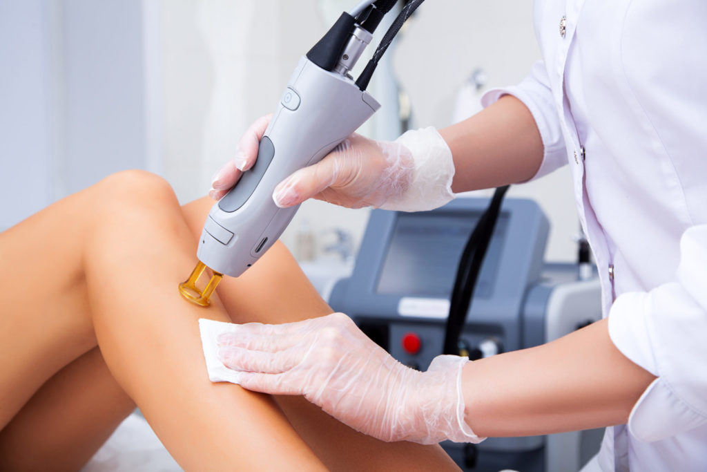 Laser Hair Removal Philadelphia 2