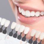 veneers in philadelphia