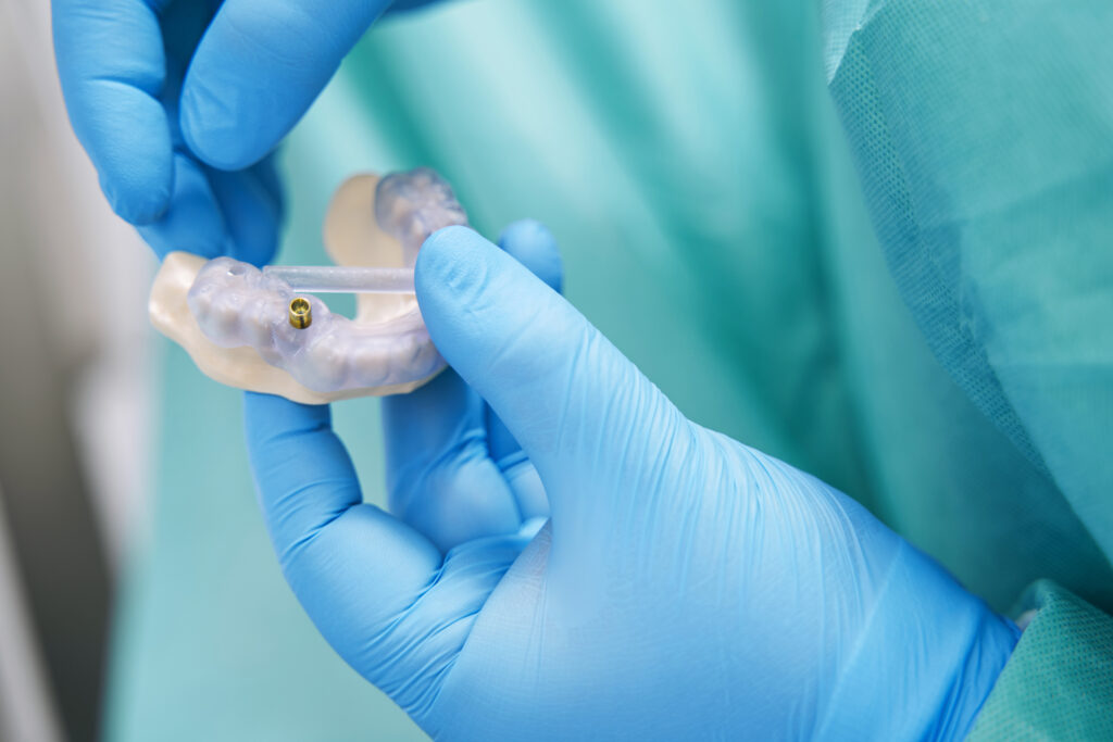 dental implants philadelphia pa 2