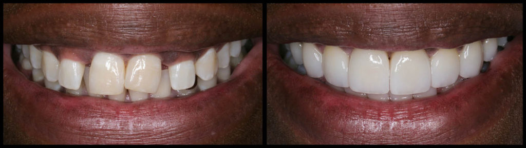 cosmetic dentistry philadelphia pa 2