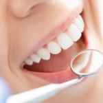 longevity of dental implants 2