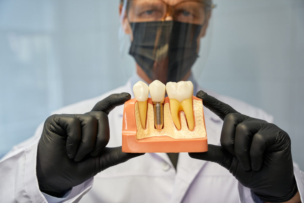 dental implant services philadelphia