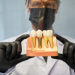 dental implant services philadelphia