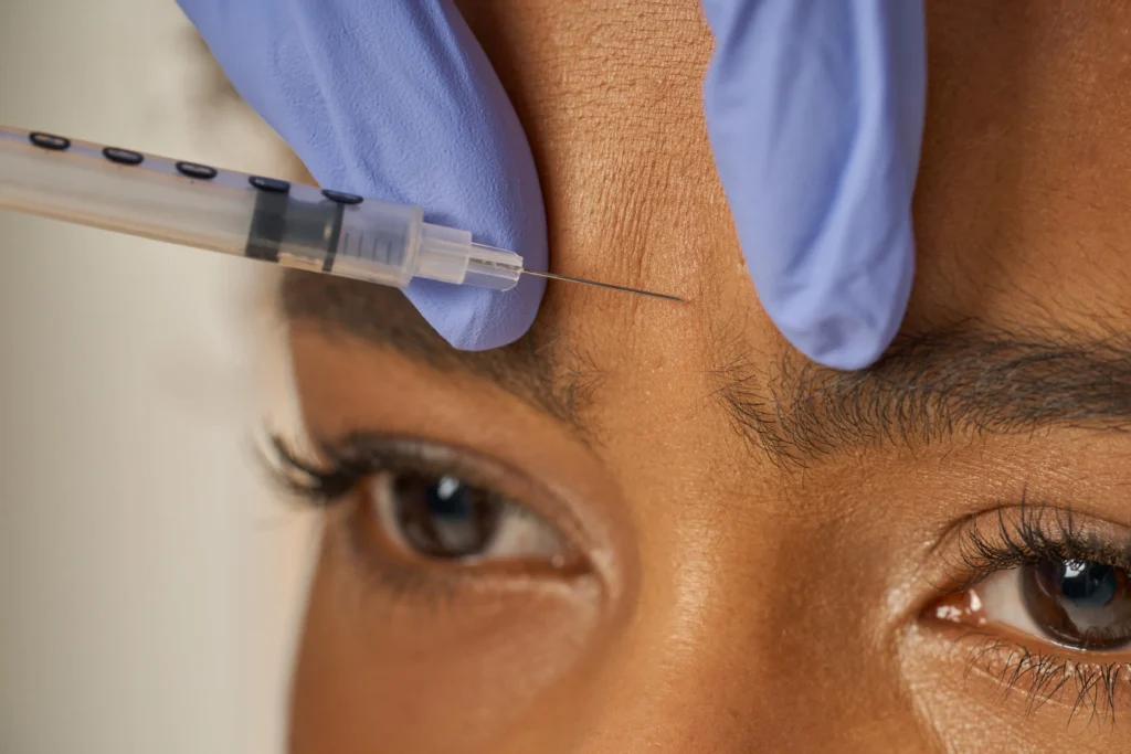 Close-up of Botox injection in the forehead to relax wrinkles and minimize pores.