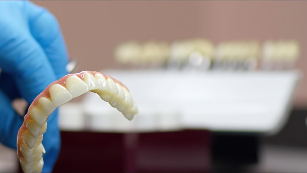Close-up of zirconia dental bridge held by dentist in a gloved hand.