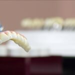 Close-up of zirconia dental bridge held by dentist in a gloved hand.
