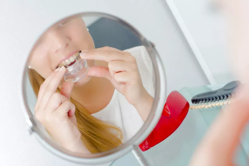 Woman placing a dental aligner in front of a mirror for orthodontic treatment and teeth straightening