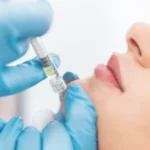 lip filler injection close-up