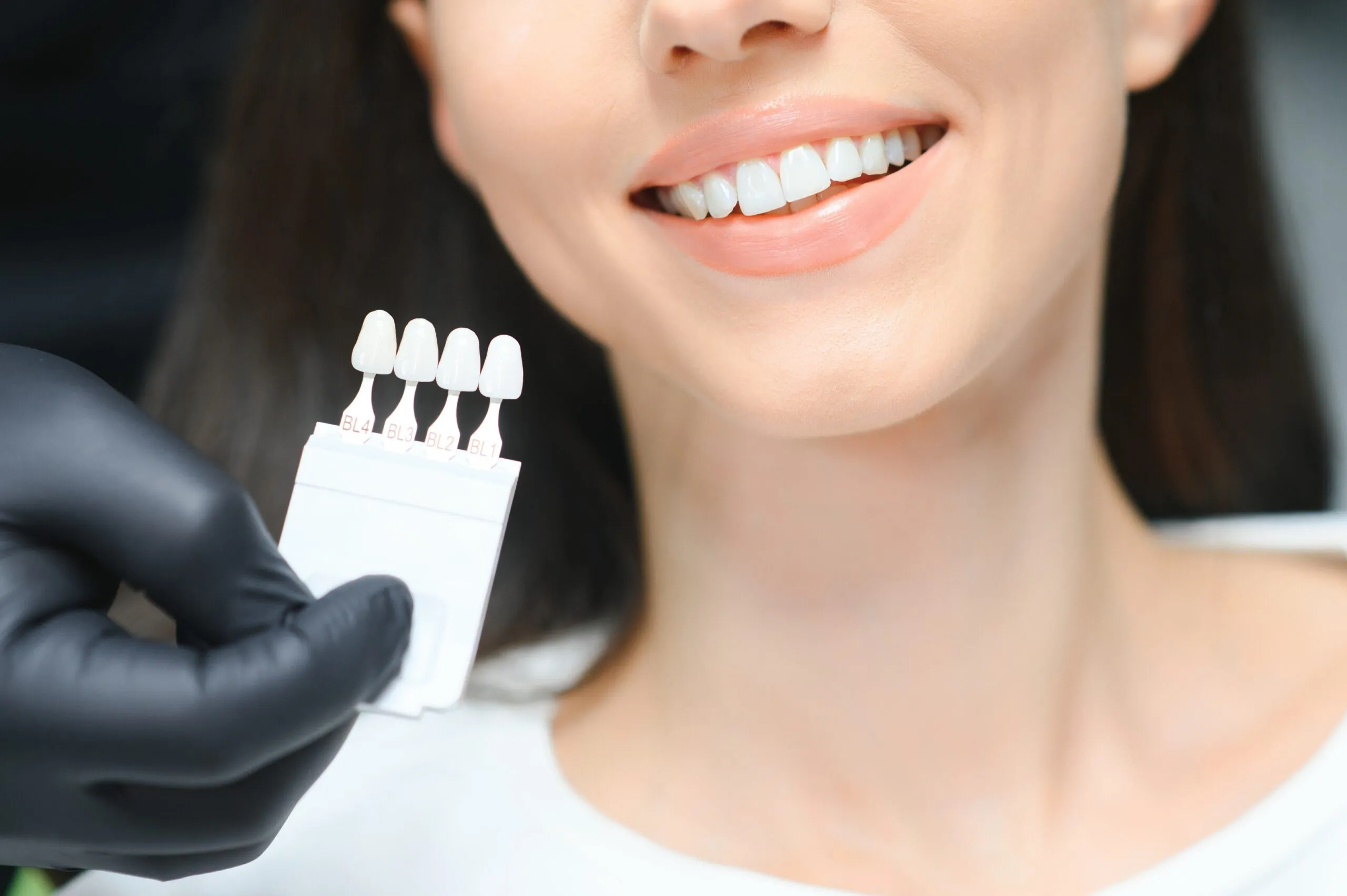 veneers philadelphia pa 2