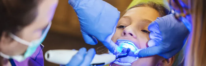 Composite Fillings