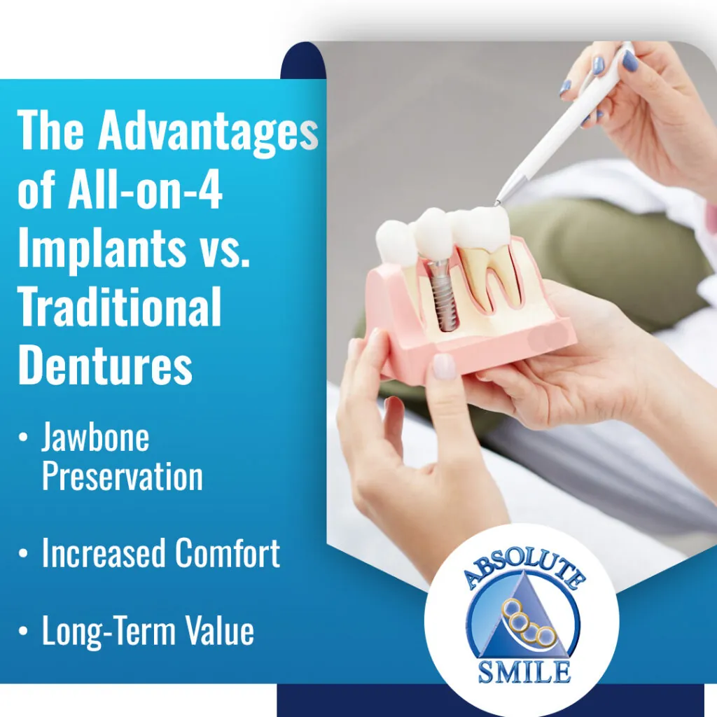 traditional dentures