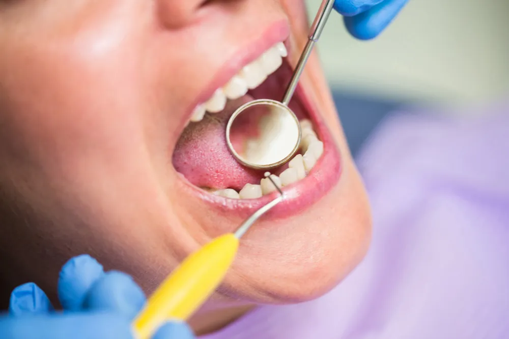 tooth repair philadelphia