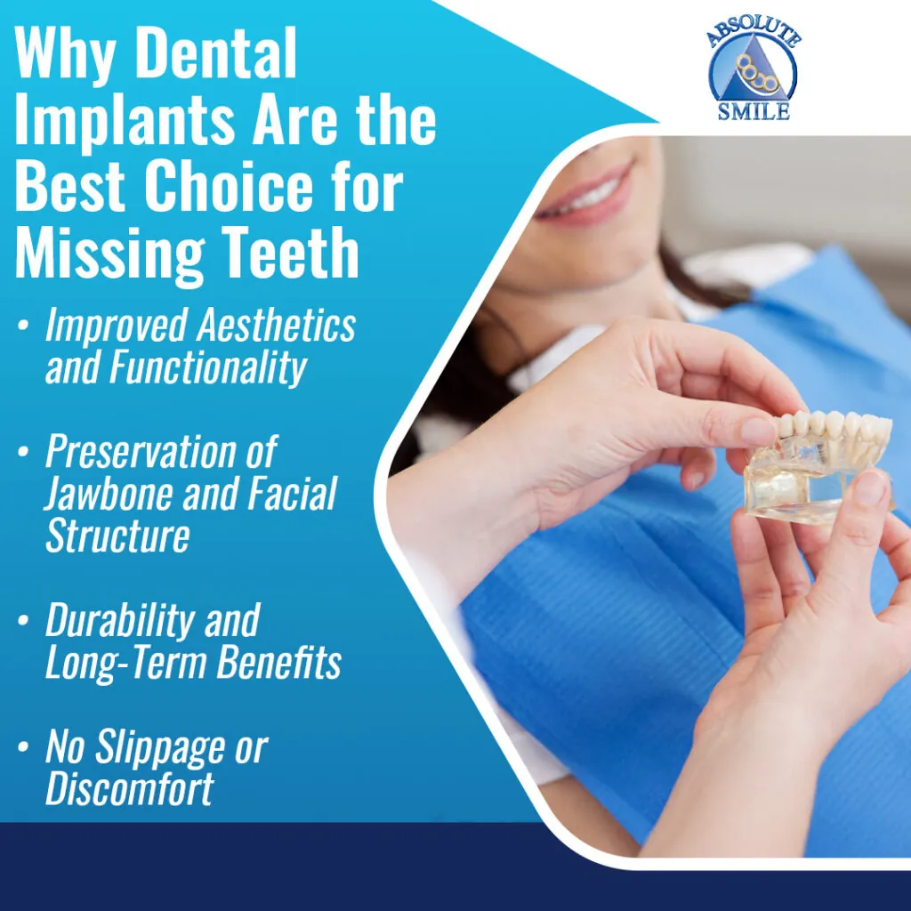 tooth replacement